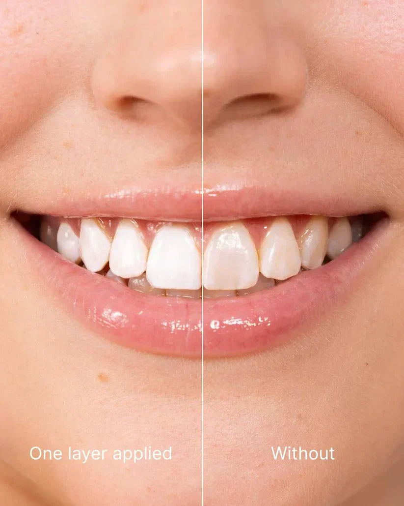 Elina™ | Instant Smile Polish | 1 + 1 GRATIS