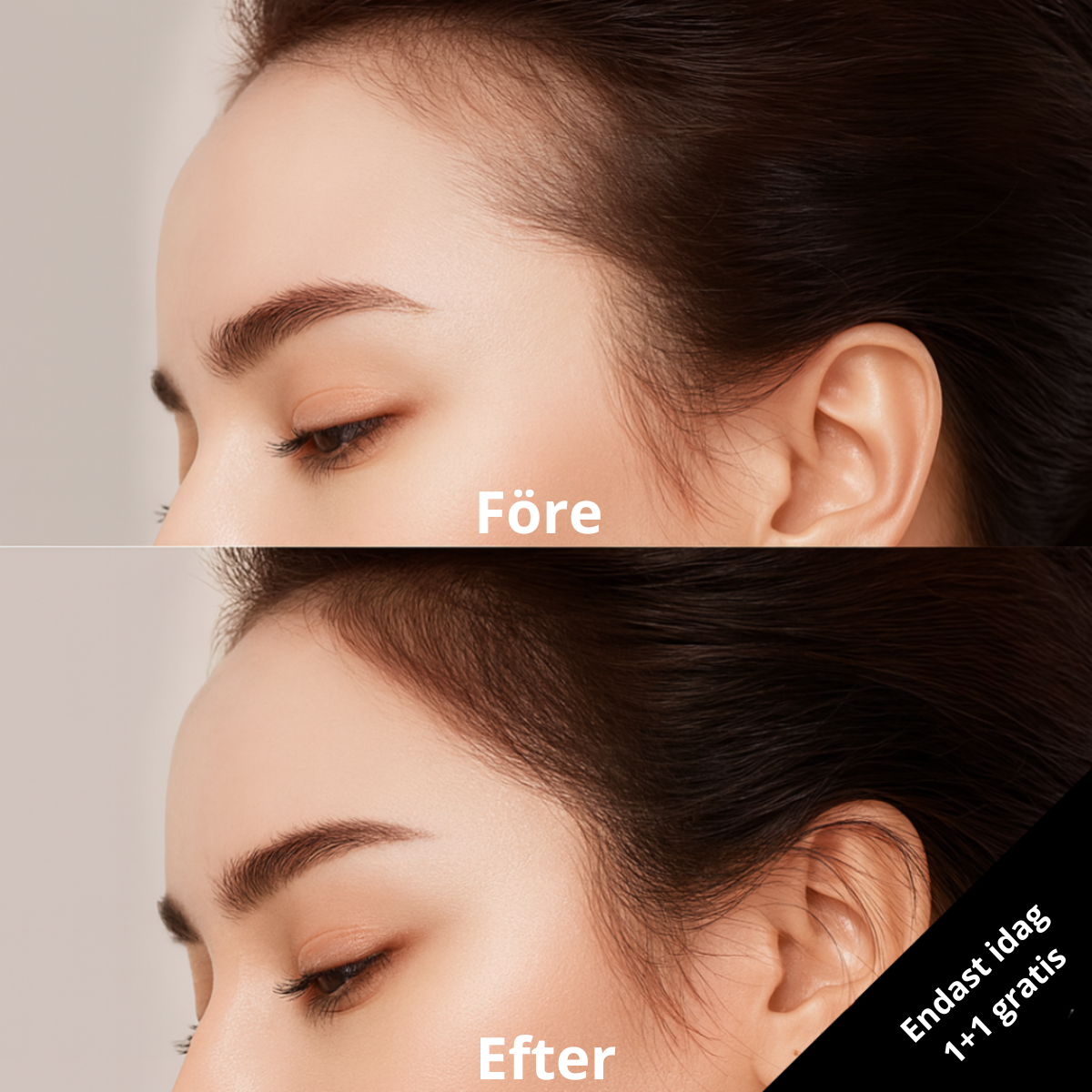 HairGlow™ | Direkt Hårlinje Korrigerare | 1 + 1 GRATIS