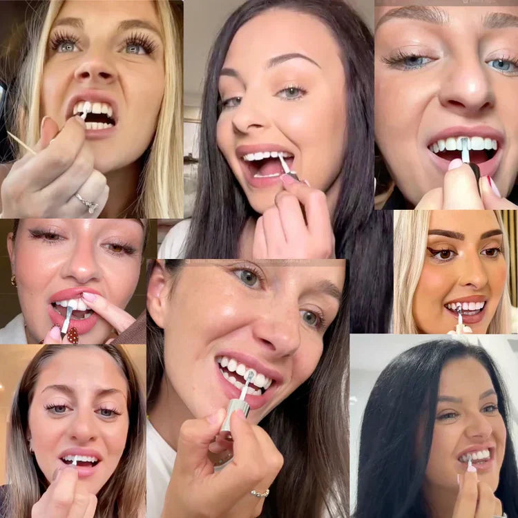 Elina™ | Instant Smile Polish | 1 + 1 GRATIS