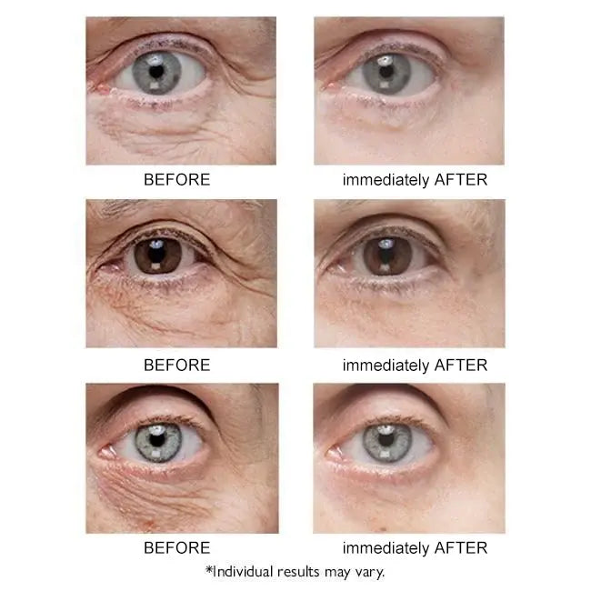 Instant Eye Lift™ | 1+1 GRATIS