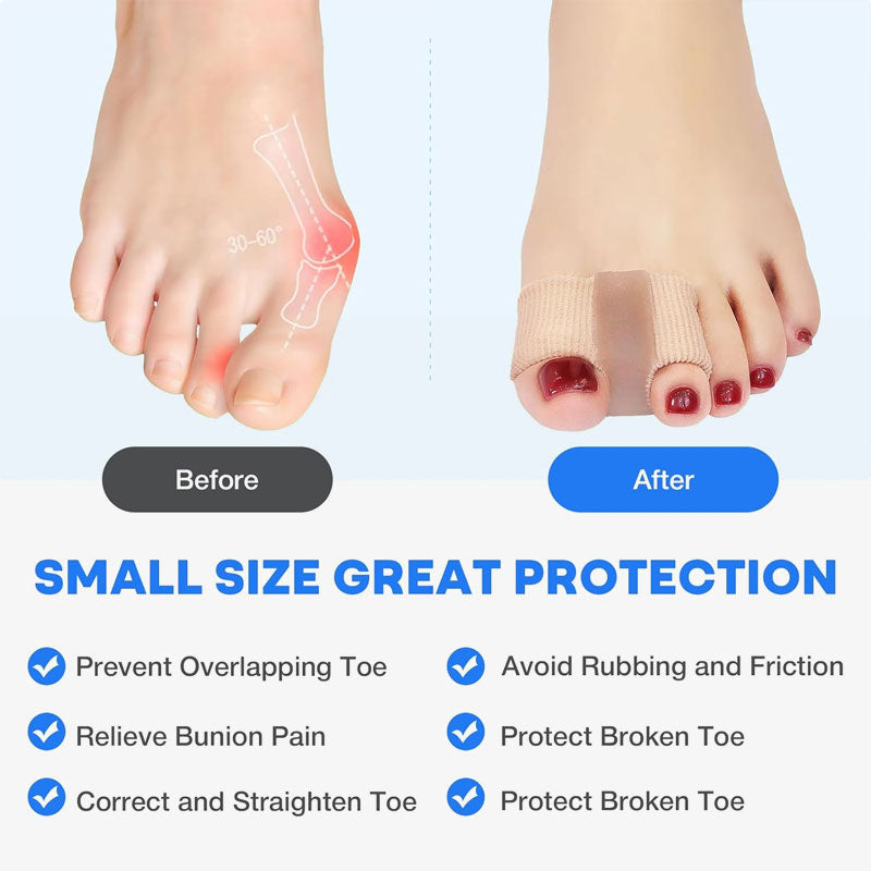 Mila™ | Easy Stepper – Tåspridare & Hallux Korrigerare