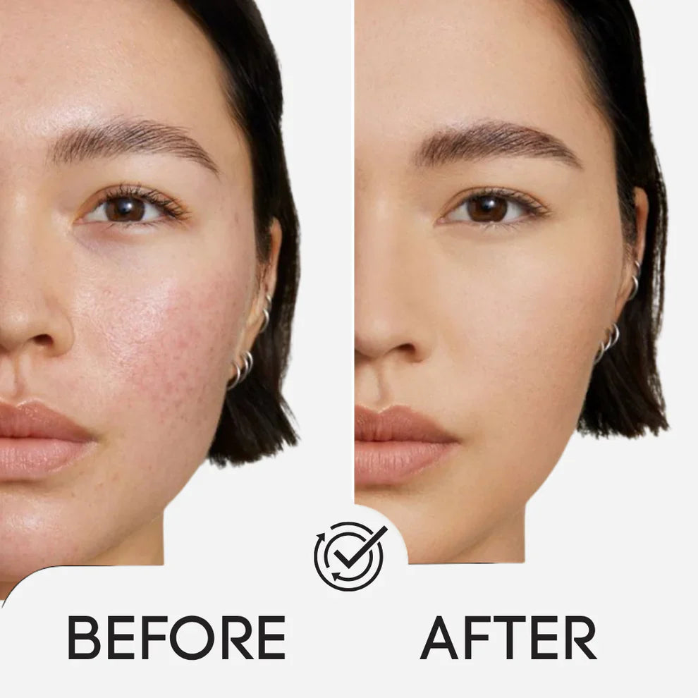 Lumora™ | Glow Pads