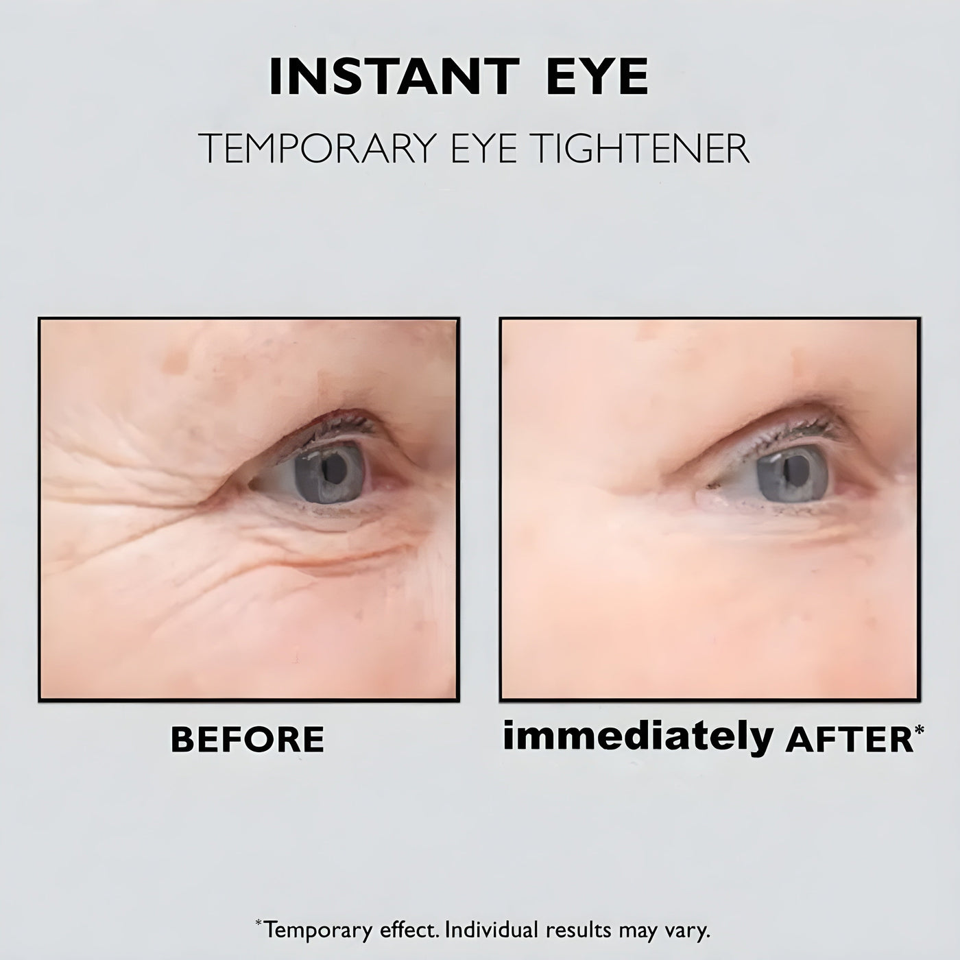 Instant Eye Lift™ | 1+1 GRATIS
