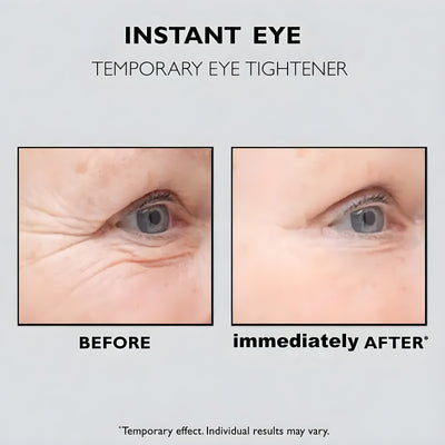 Instant Eye Lift™ | 1+1 GRATIS