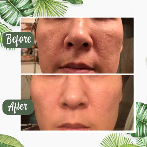 Klara™ | Green Tea Deep Mask 1 + 1 GRATIS