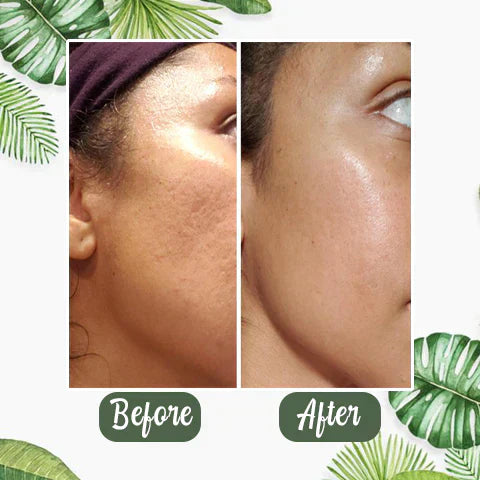 Klara™ | Green Tea Deep Mask 1 + 1 GRATIS