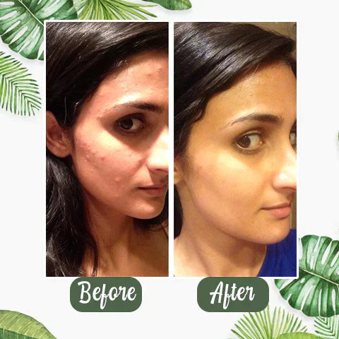 Klara™ | Green Tea Deep Mask 1 + 1 GRATIS