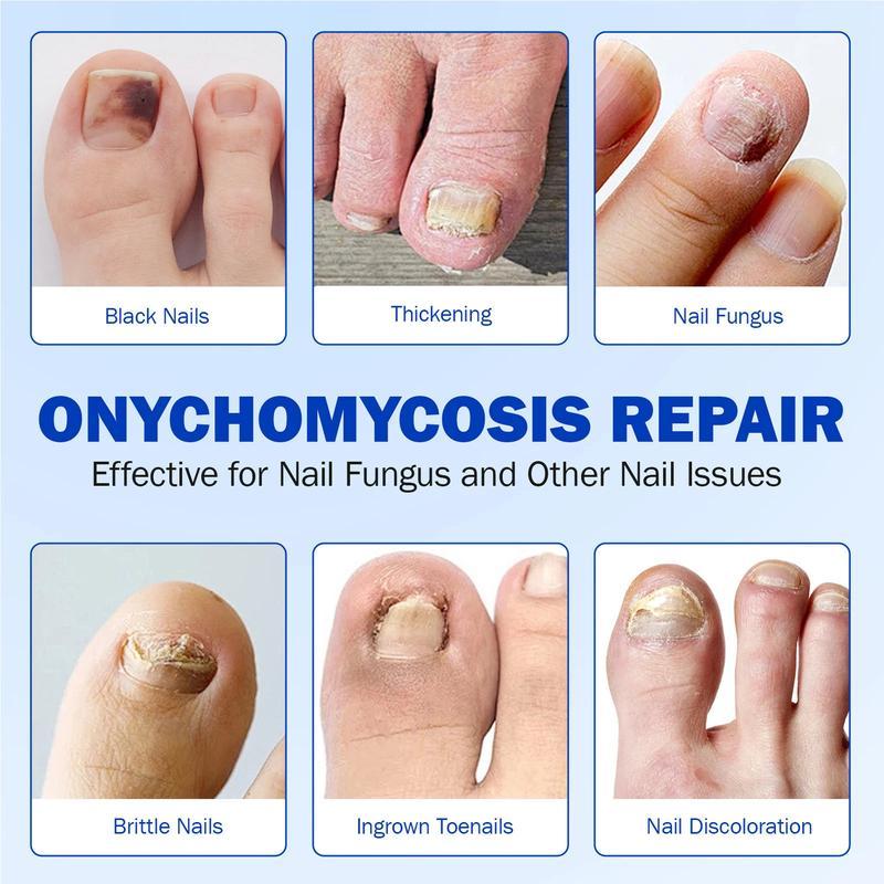 ClearNail™ | Overnight Nail Repair Patches | 1 + 1 GRATIS
