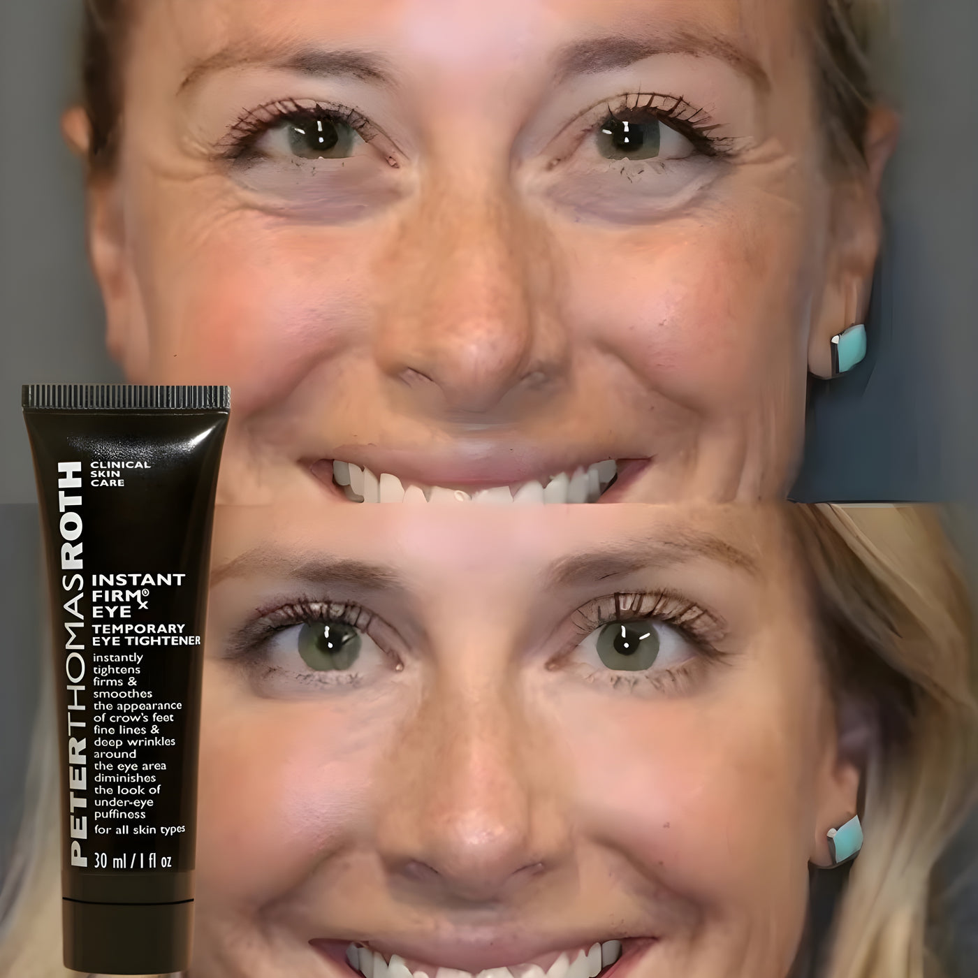 Opulent Eye Revival™ | 1 + 1  GRATIS